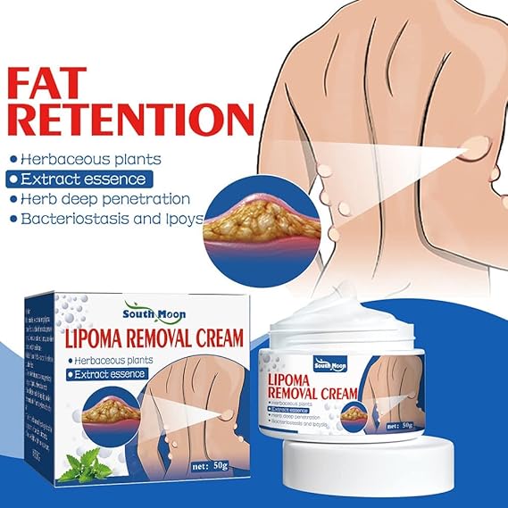 South Moon Lipoma Removal Cream